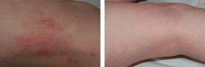 Un très petit membre non dans létat de lérection